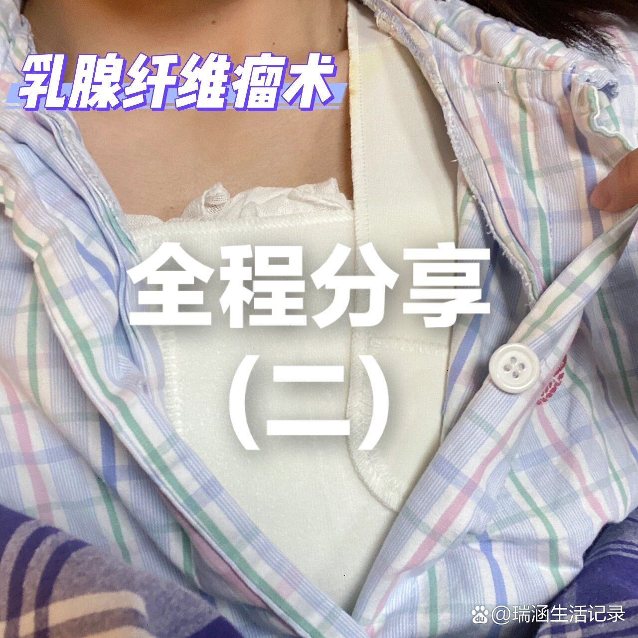 乳腺纤维瘤手术