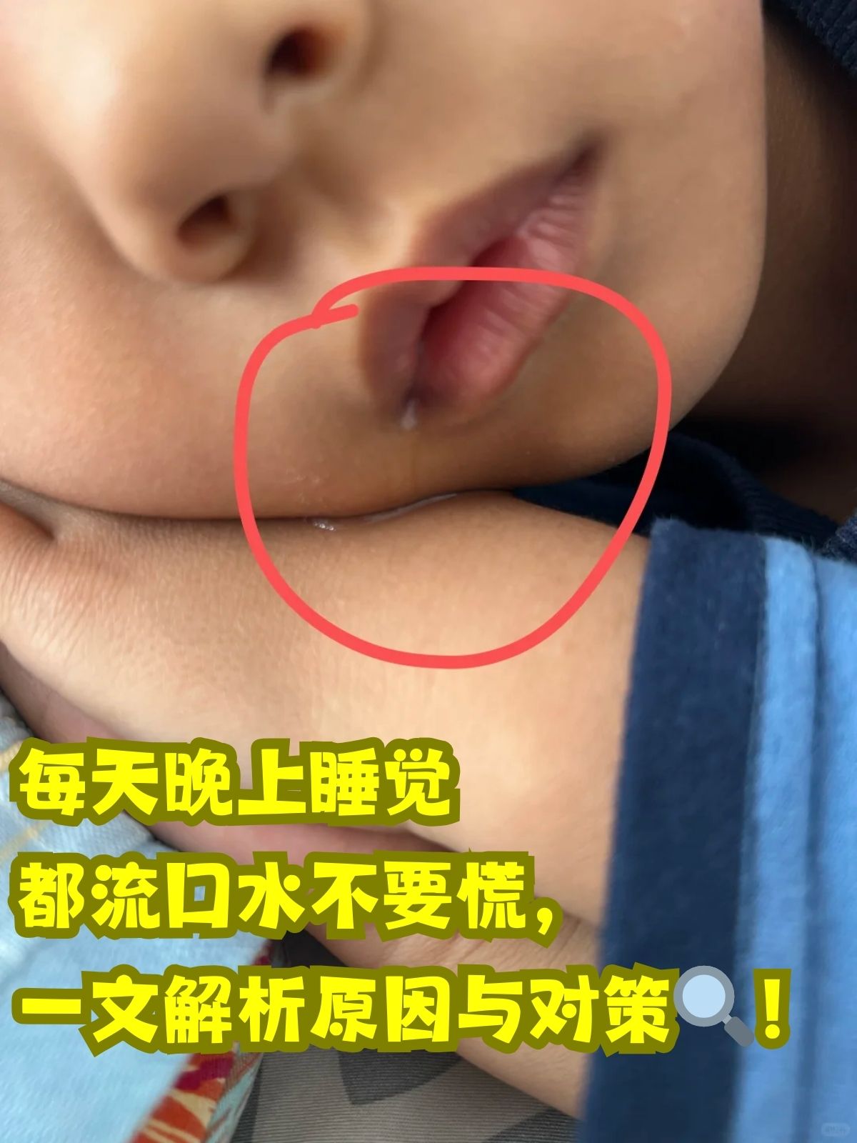 侧着睡流口水是怎么回事