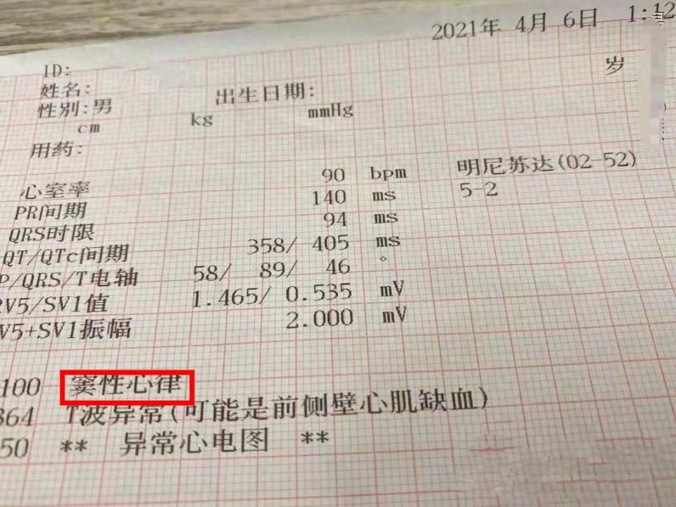 窦性心律过快怎么办