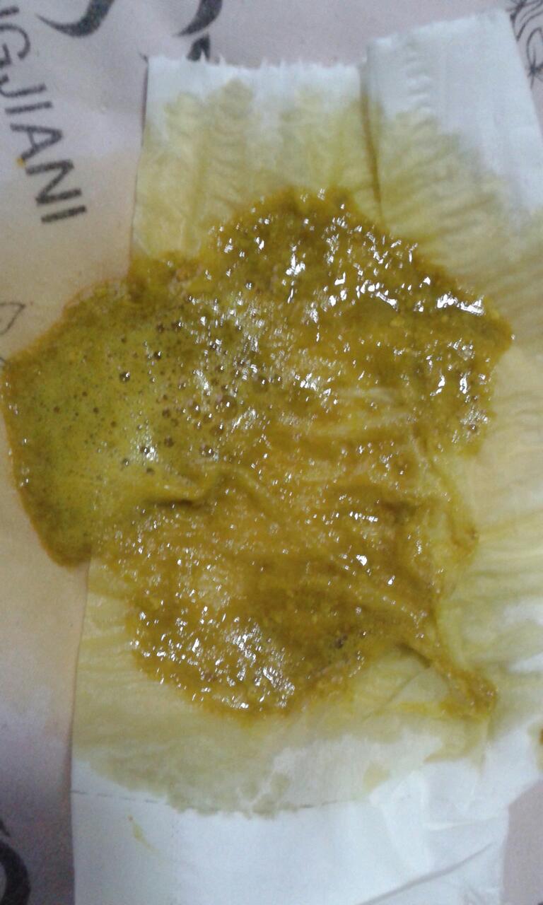 大便有泡沫正常吗