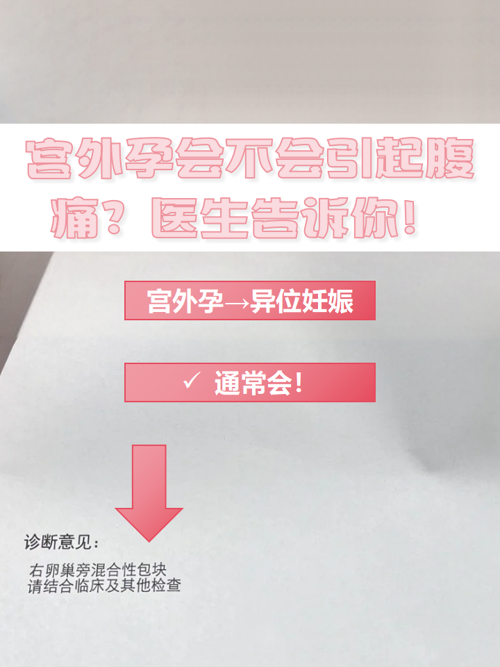 什么原因引起宫外孕