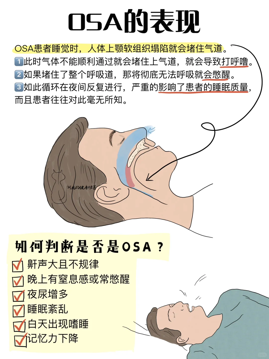 治打呼噜的最简单办法是什么