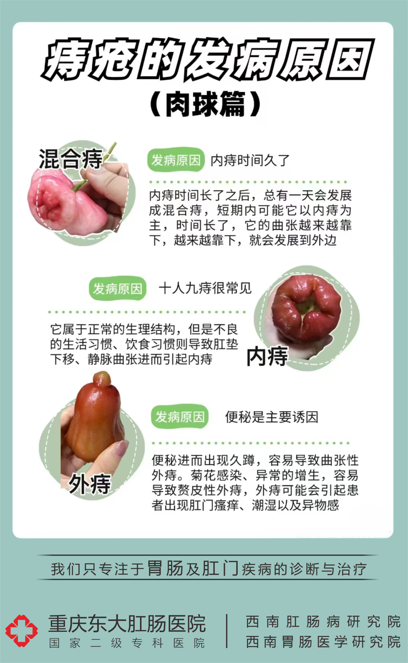 痔疮检查项目有哪些