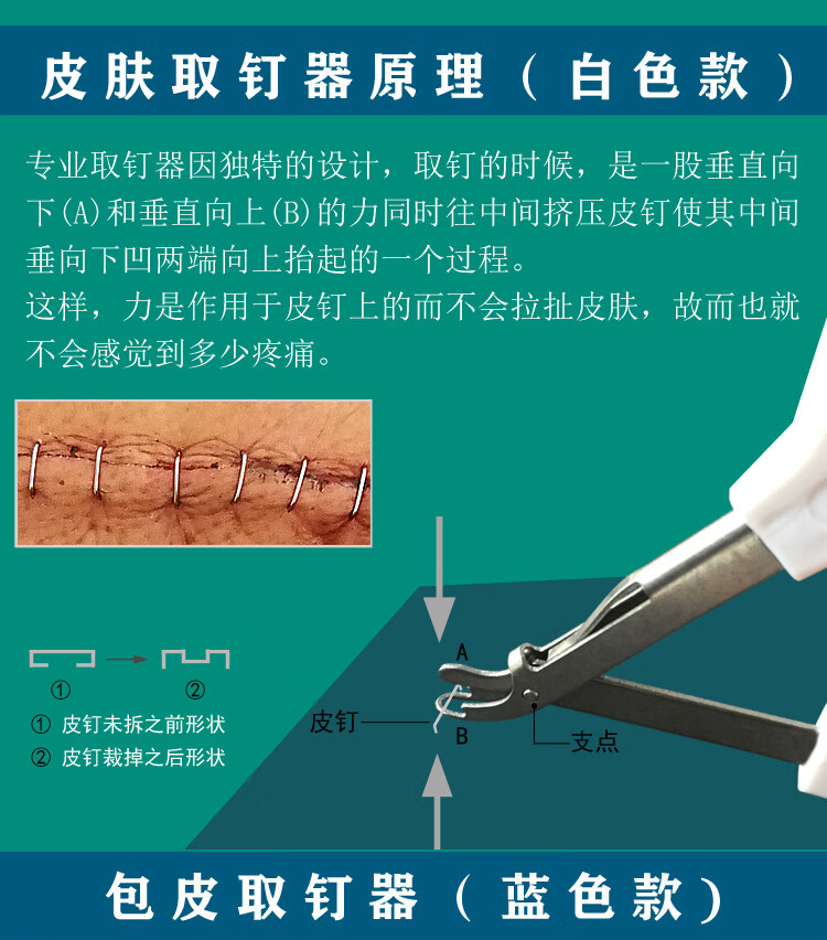 商环手术消肿