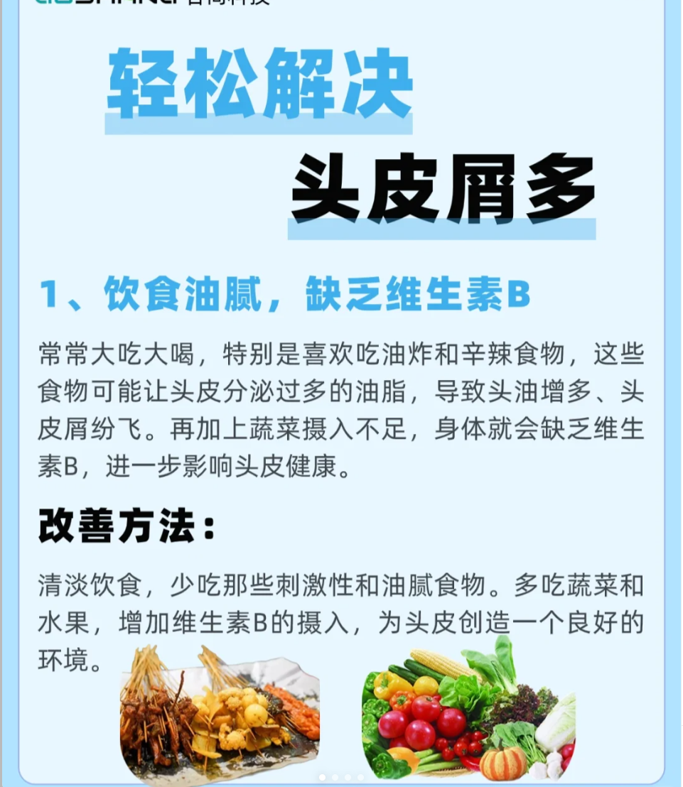 头皮屑多,不疼不痒,怎么办