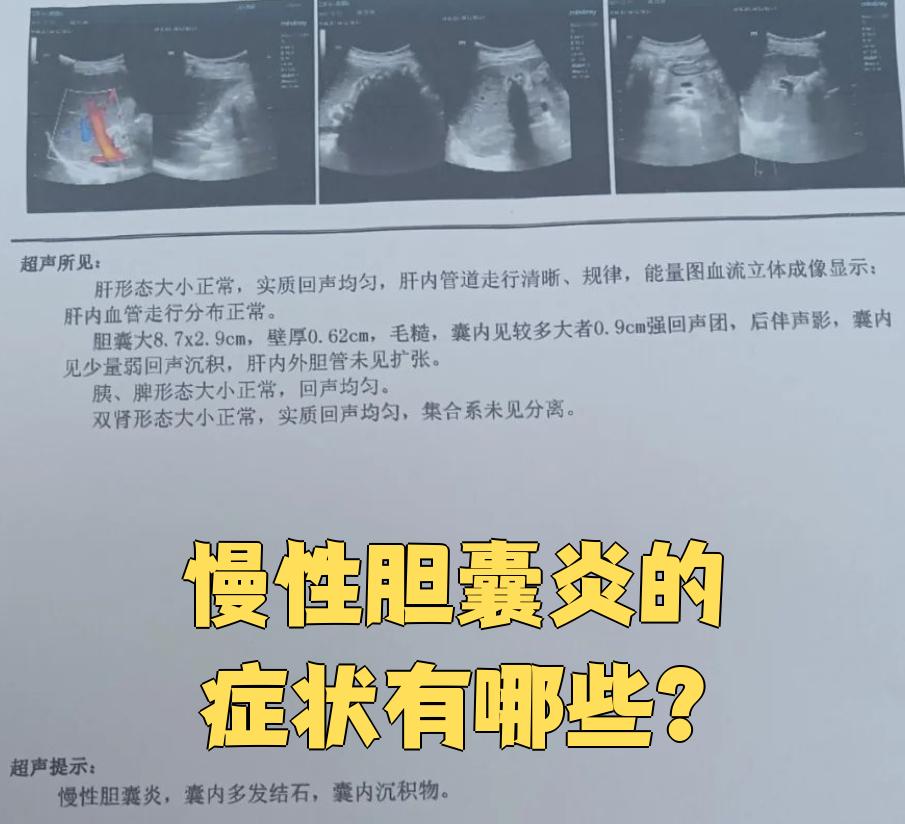 胆囊炎发作时的症状