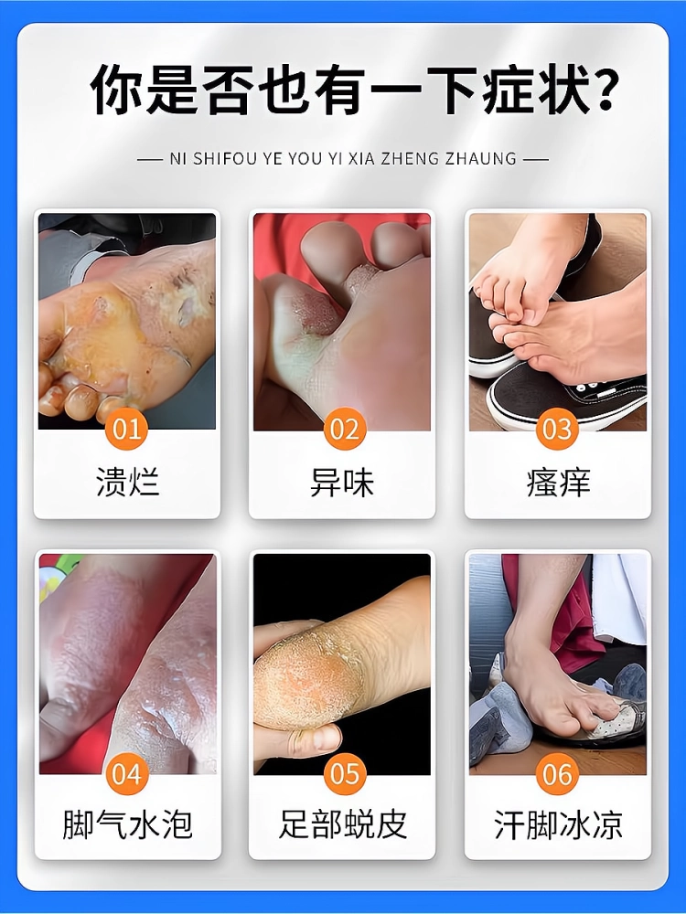 脚脱皮,可以怎么治疗
