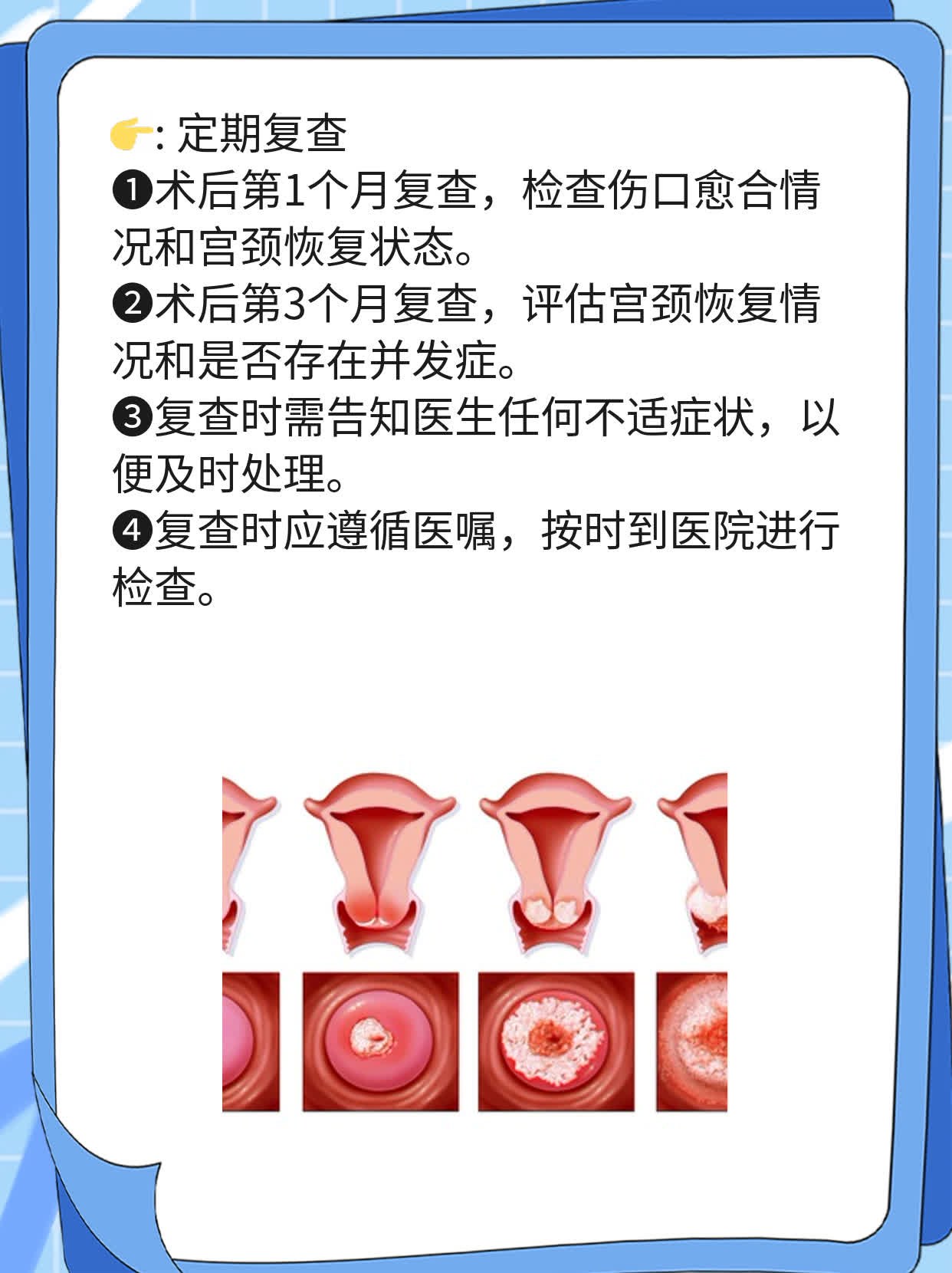 宫颈糜烂手术过后注意什么呢