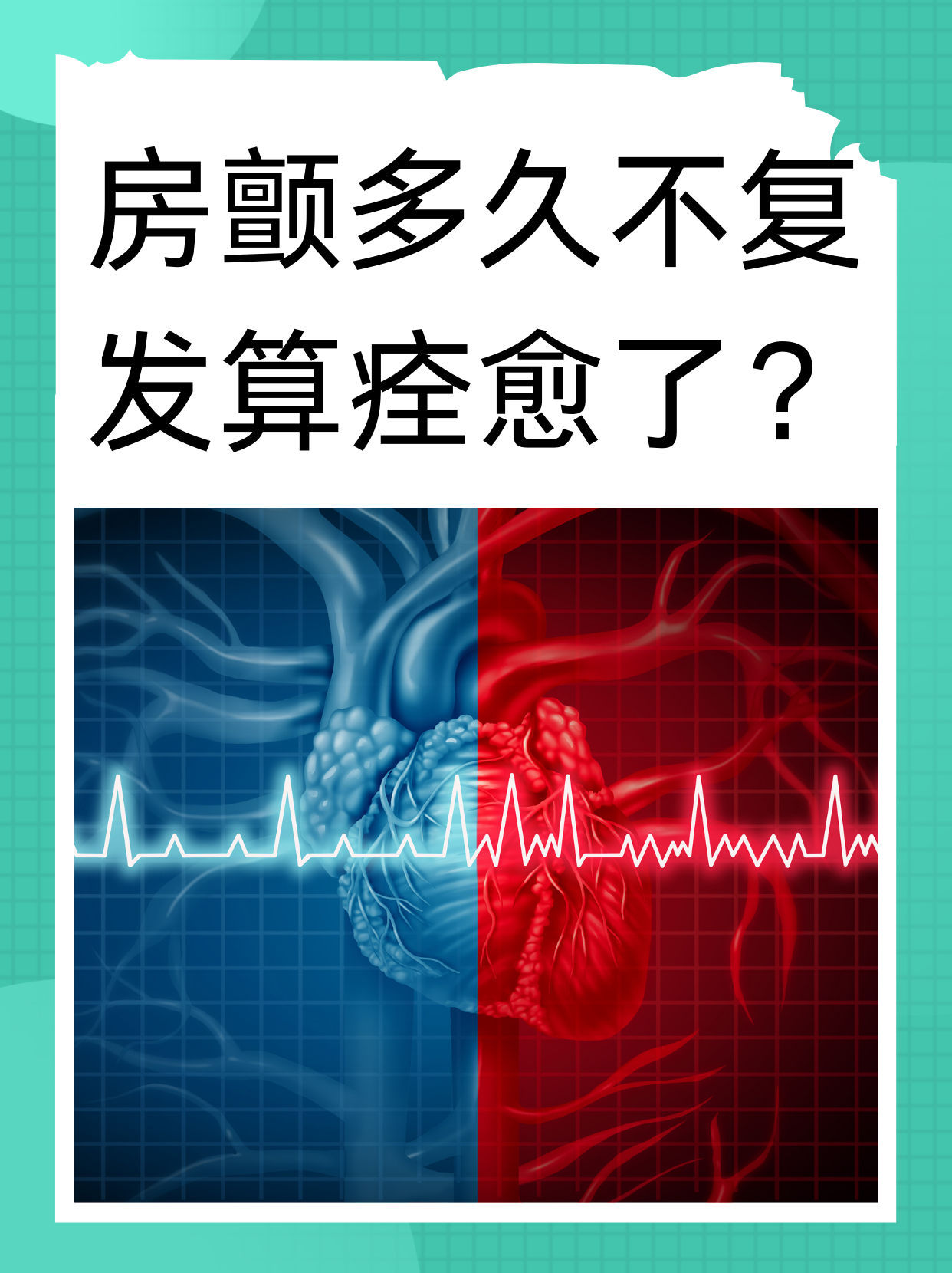 房颤的特点