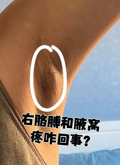 腋窝有淋巴结要紧吗?