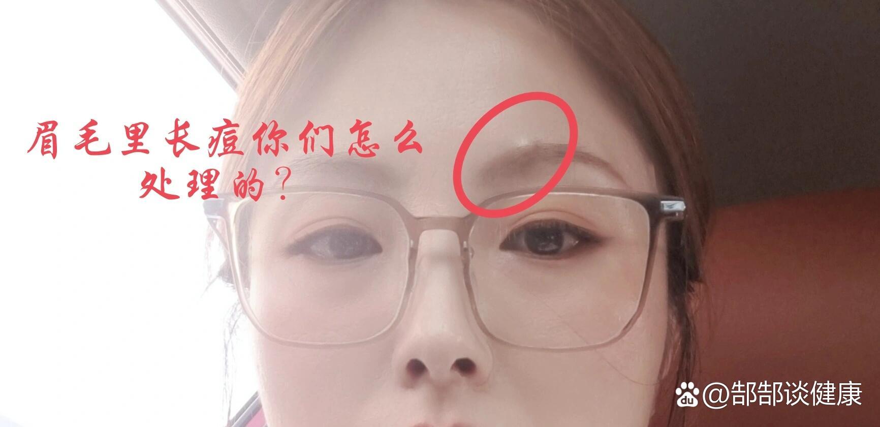 尉怀蕾 第2页