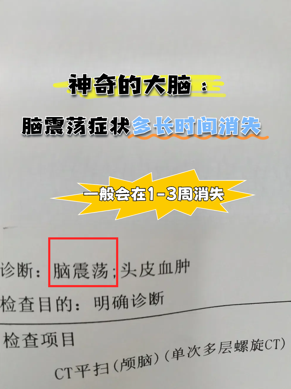 脑震荡症状有哪些
