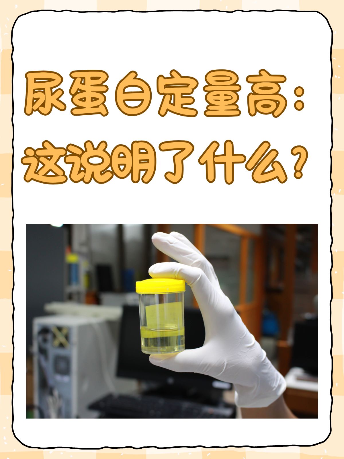 什么是蛋白尿