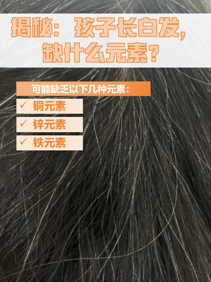 白发多是什么原因引起的