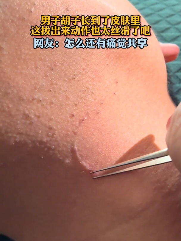 胡子拔了会长吗