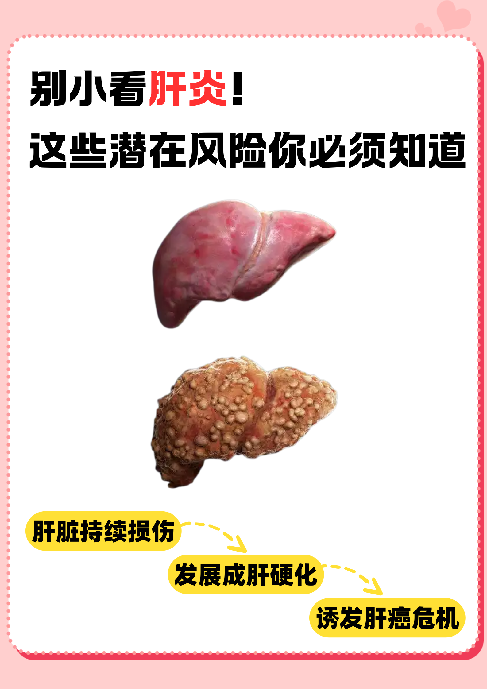 慢性肝炎有传染吗