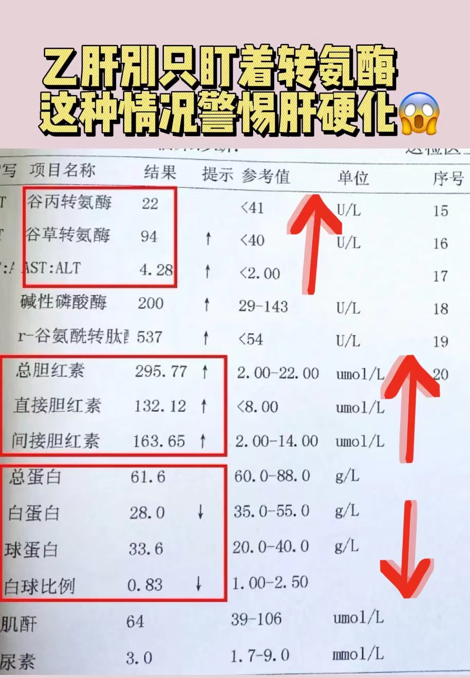 丙氨酸氨基转氨酶是什么意思