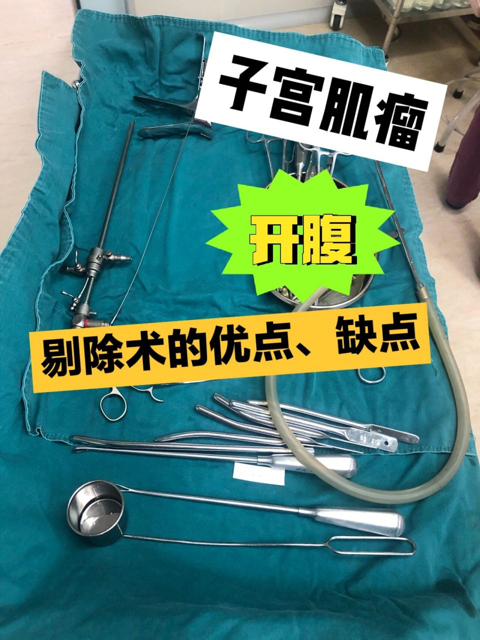 子宫肌瘤剔除术