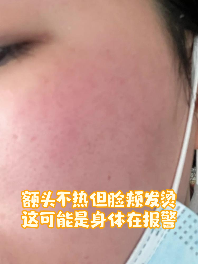 脸部发烫是怎么回事