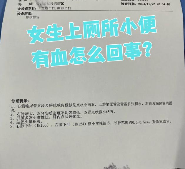 女人小便有血的原因都有哪些