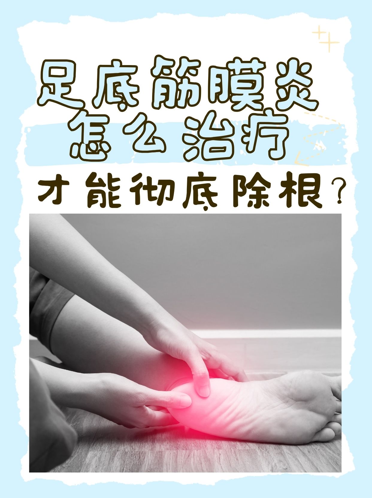 筋膜炎怎么治疗最有效呢