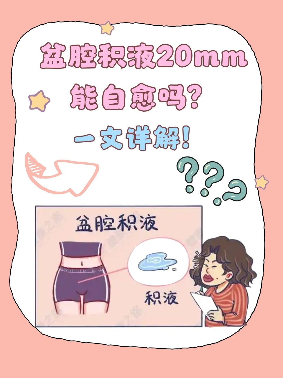 怀孕盆腔积液什么意思