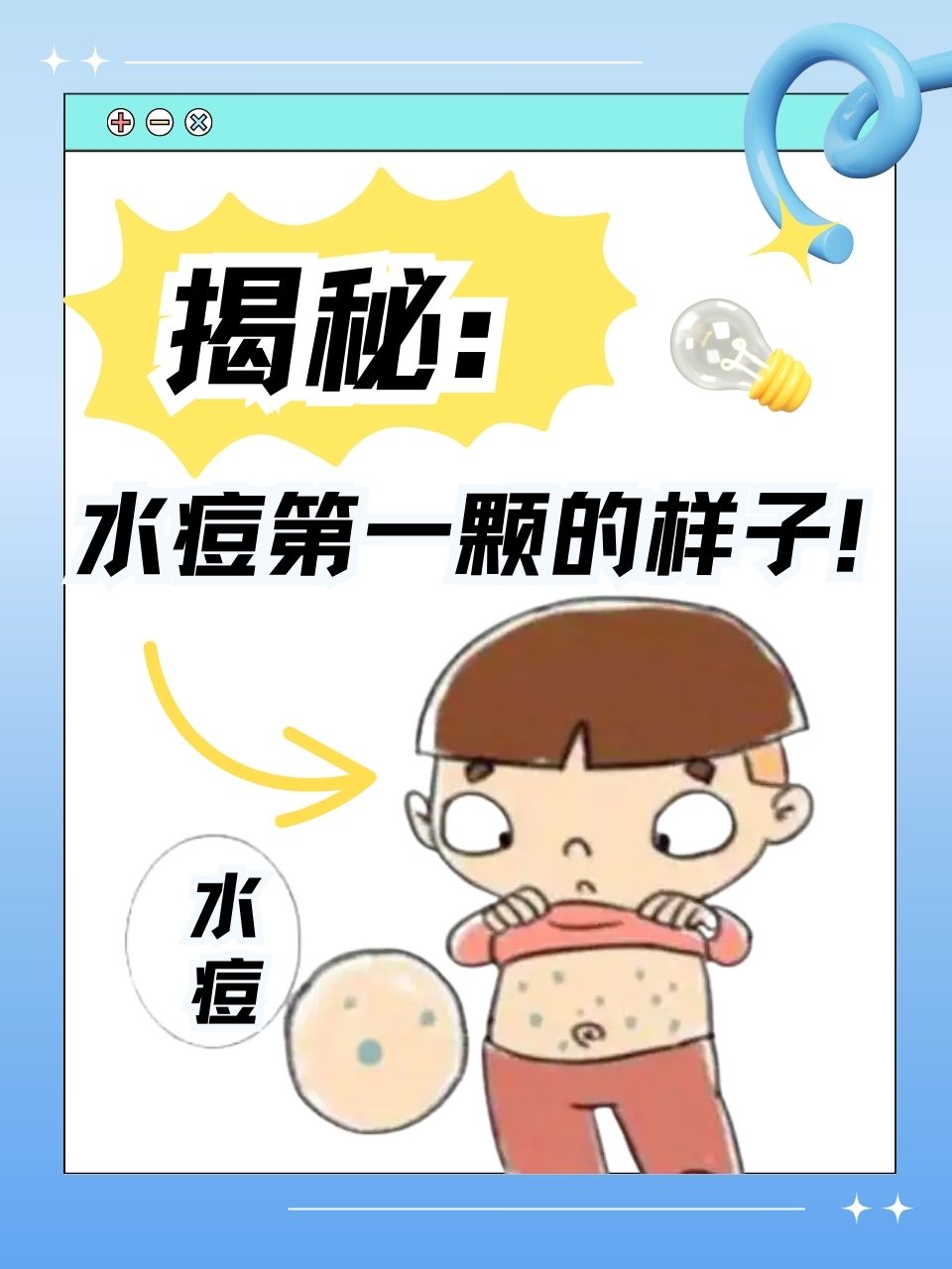 出水痘了怎么办