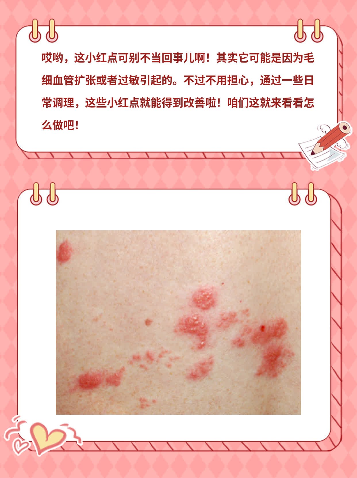 身上长红点,很痒,怎么回事