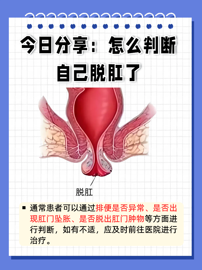 脱肛有哪些症状表现