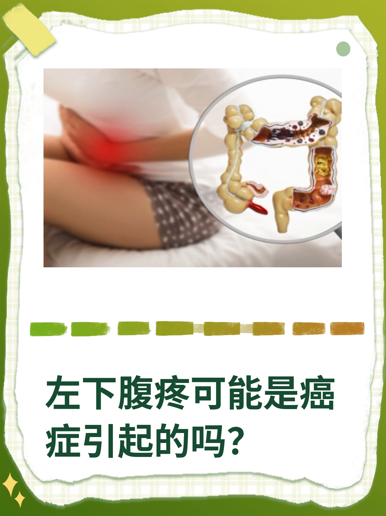 肚子左下角痛是怎么回事,