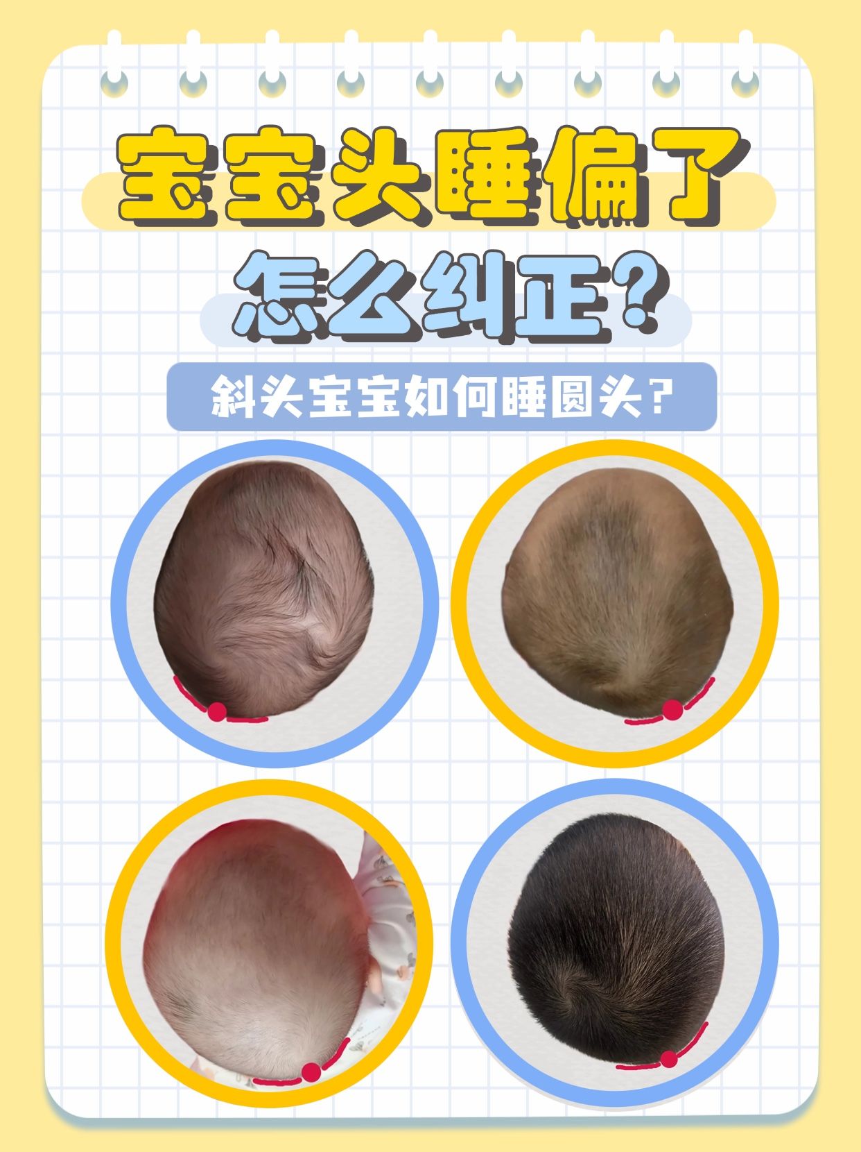 宝宝睡偏头了怎么办呢?