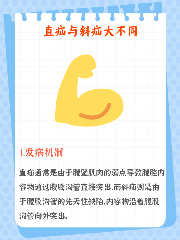 腹股沟疝科普