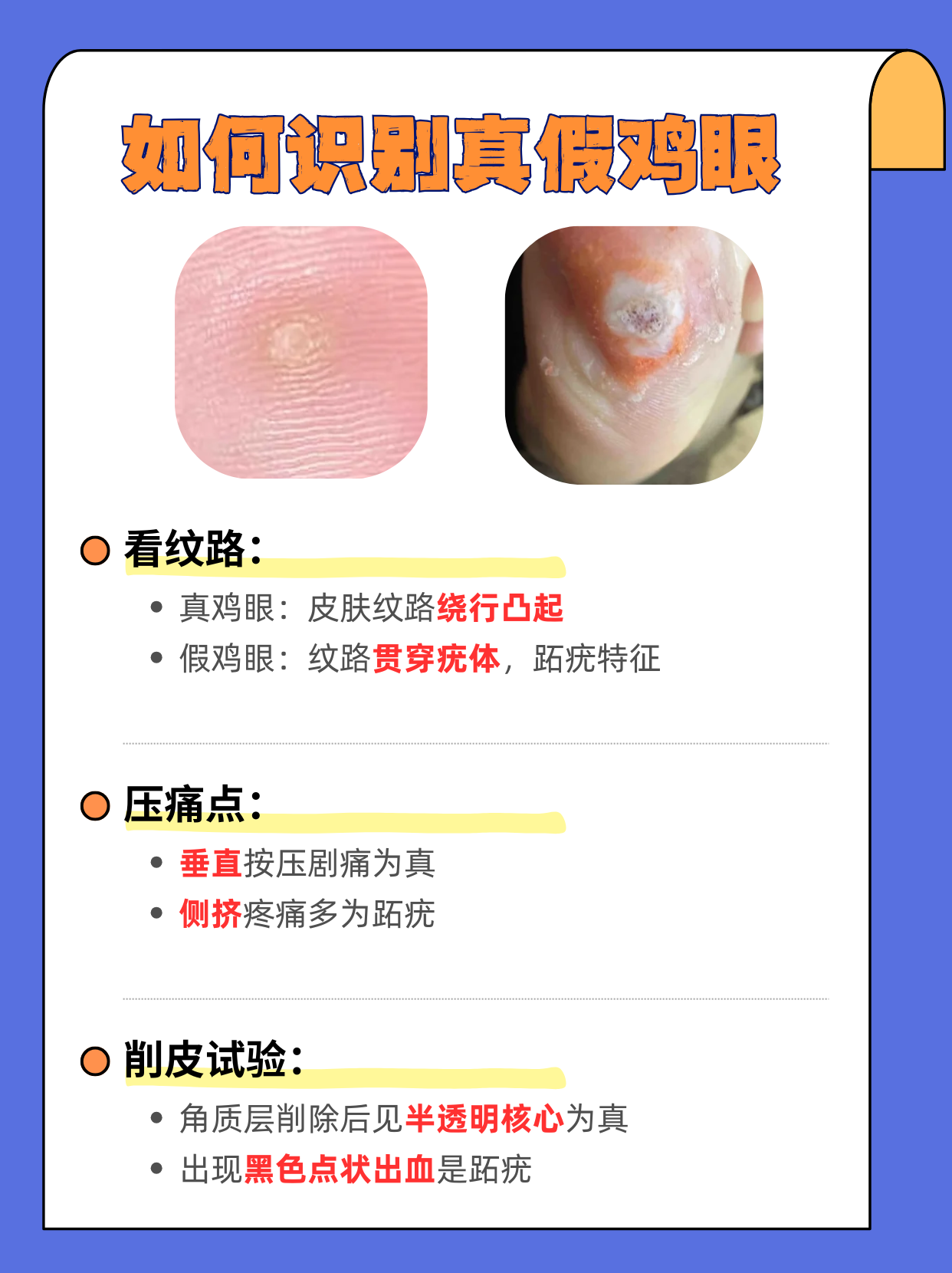 鸡眼怎么根治