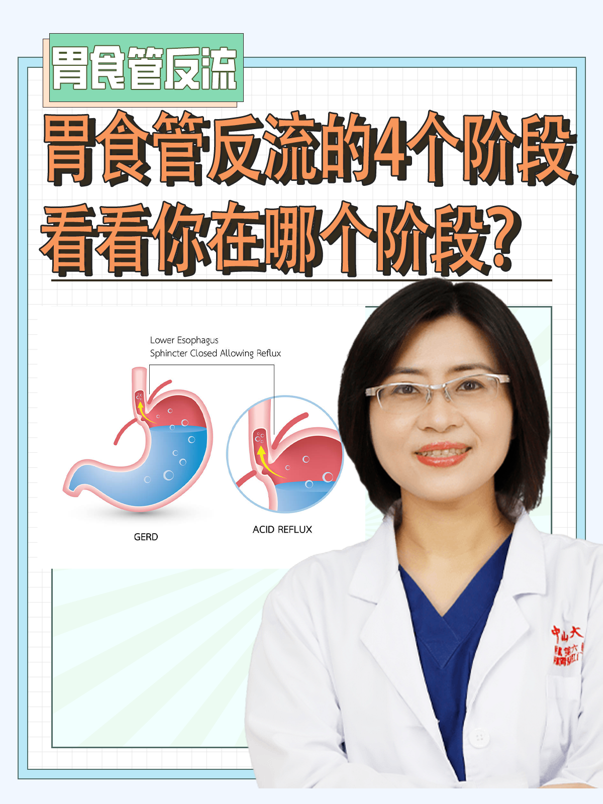 什么是胃食管反流病