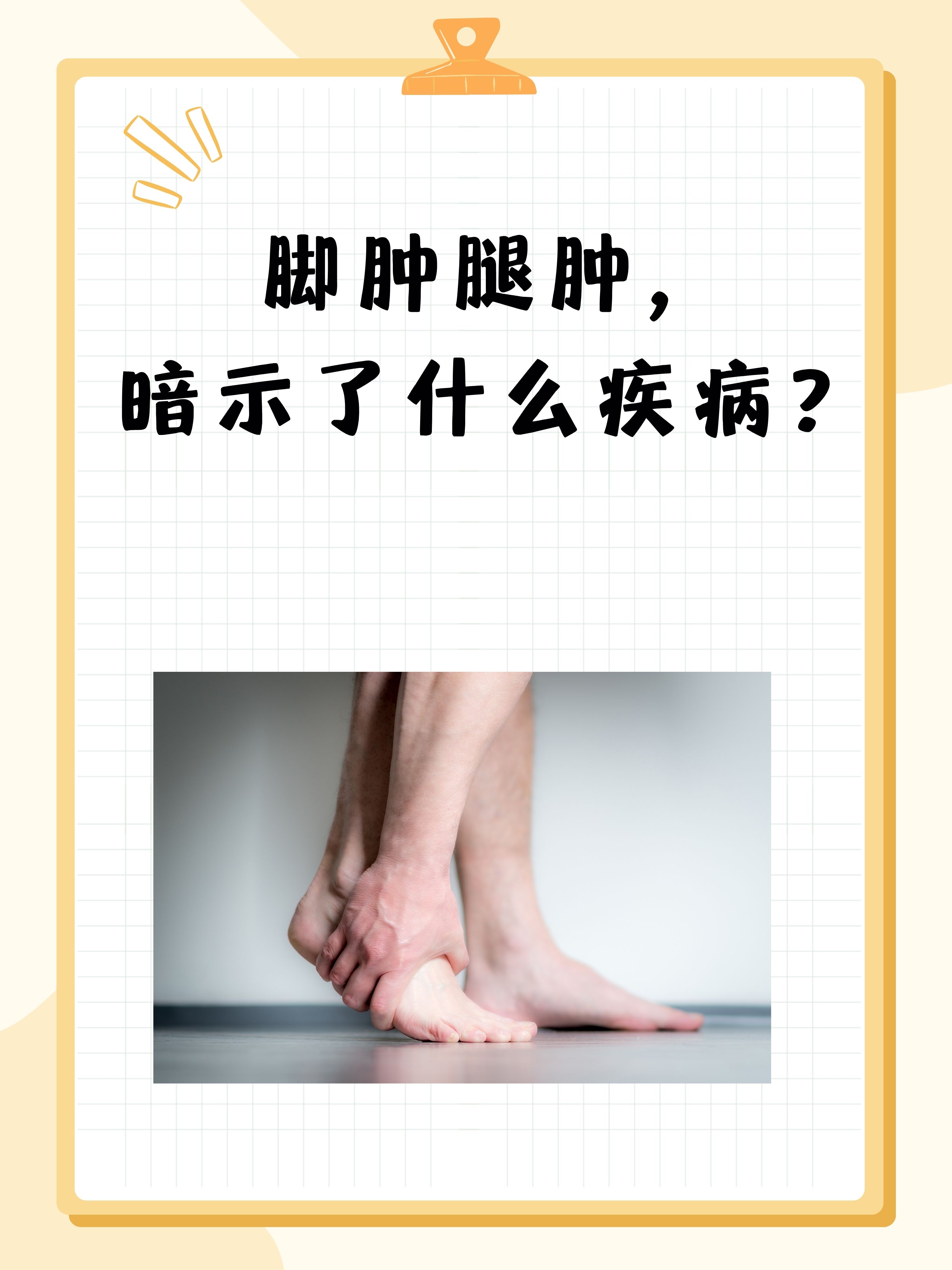脚肿腿肿是什么原因引起的