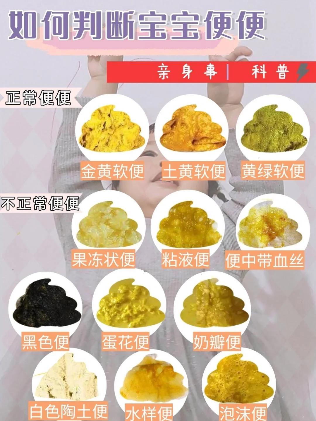 宝宝拉稀水便怎么办