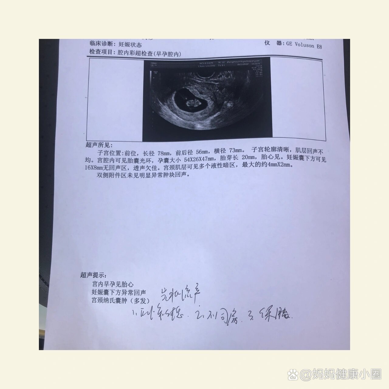 怀孕流产先兆