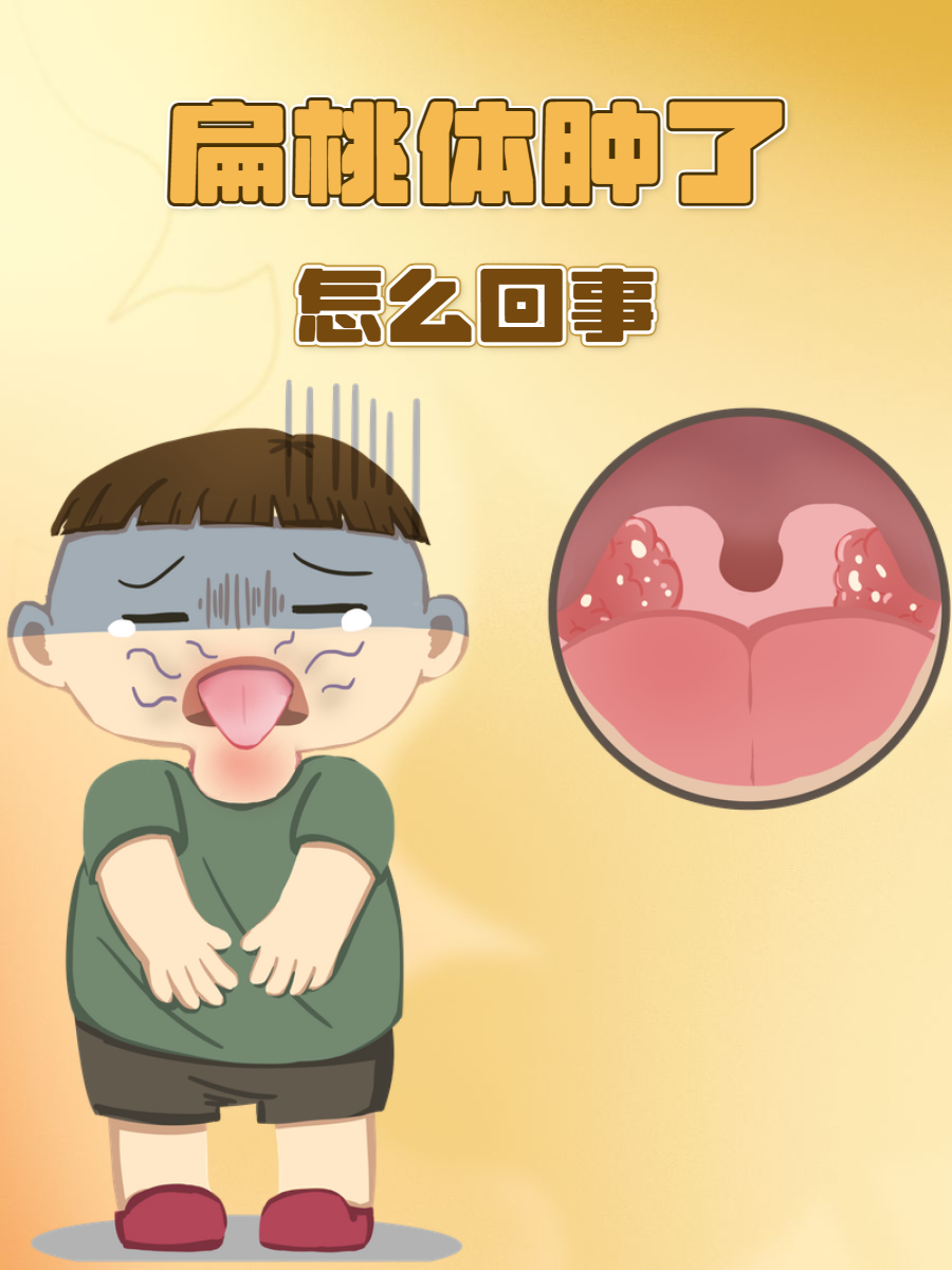 扁桃体癌怎么回事