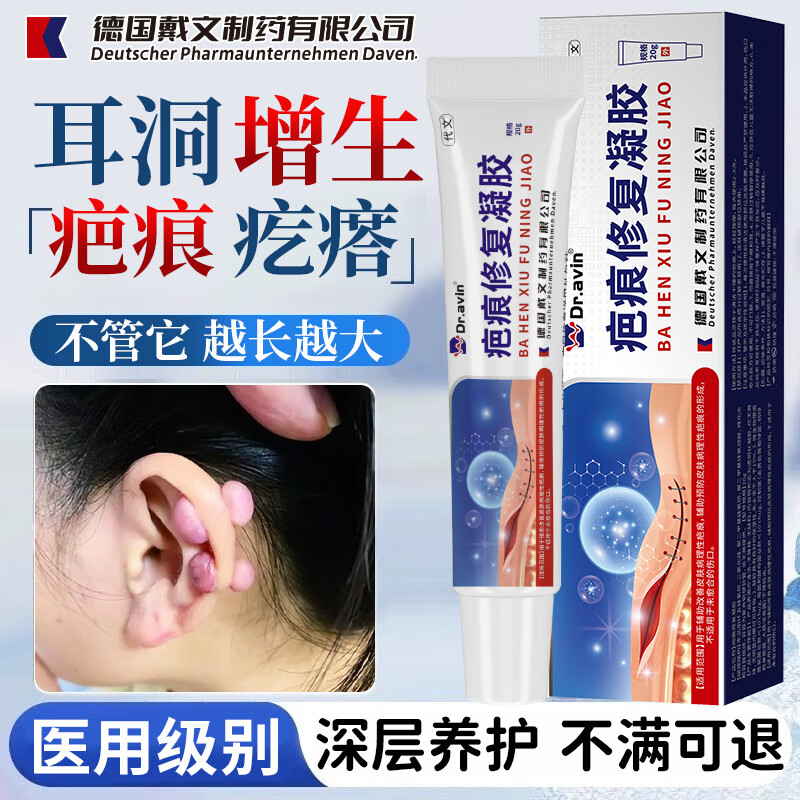 瘢痕疙瘩用什么药膏?