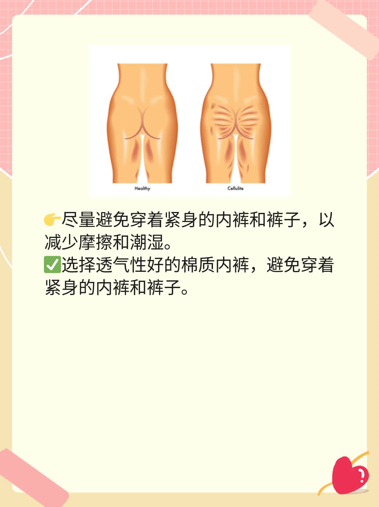 霉菌性阴道炎严重吗医生