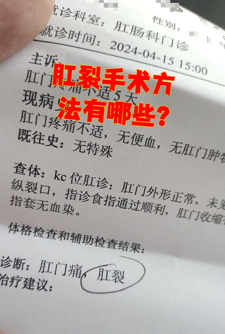 肛裂手术多长时间痊愈