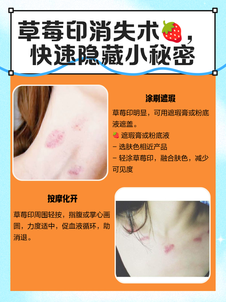 请问吻痕怎么快速消除