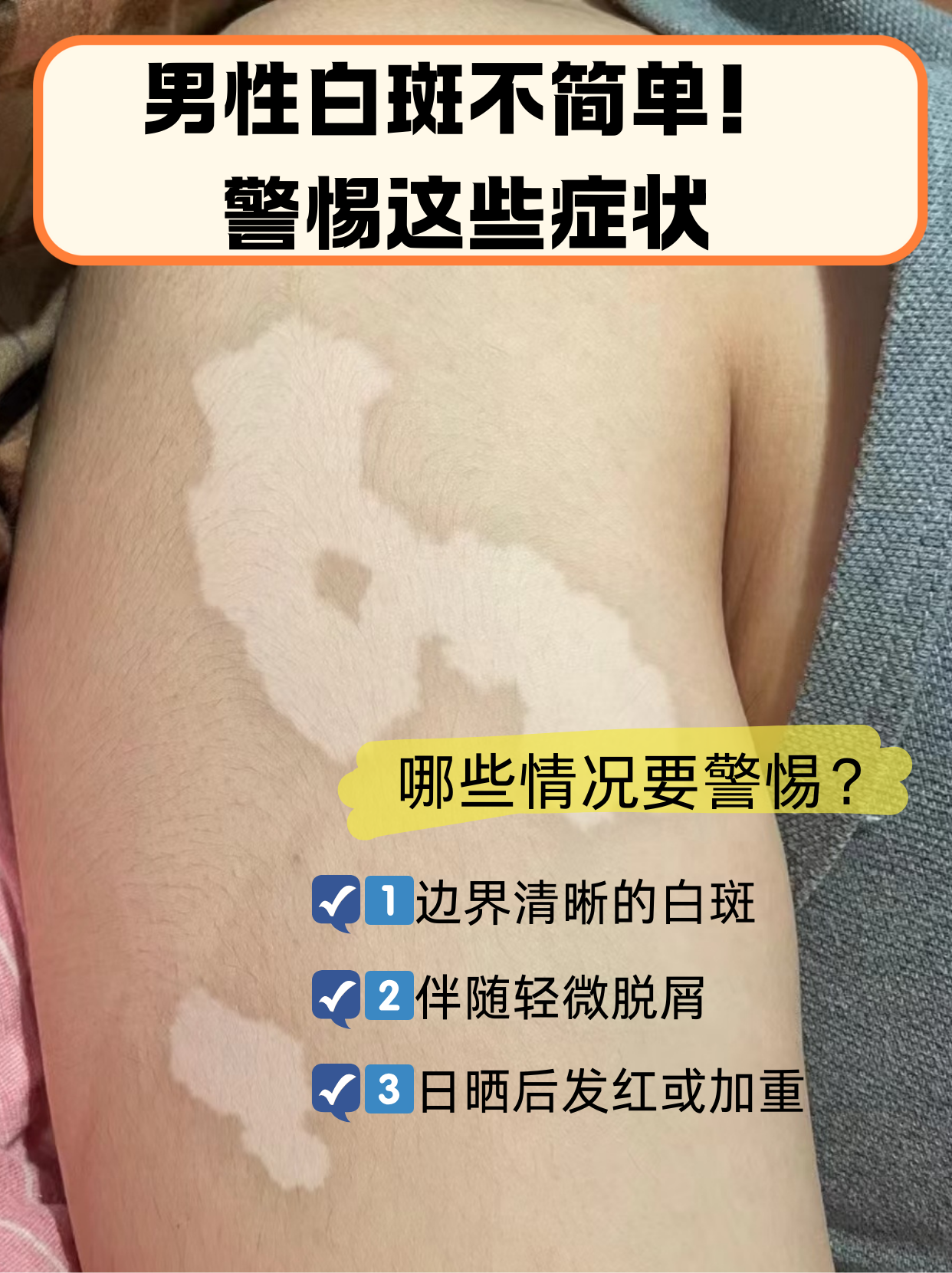 白斑会传染吗?