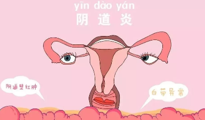为什么阴道放屁