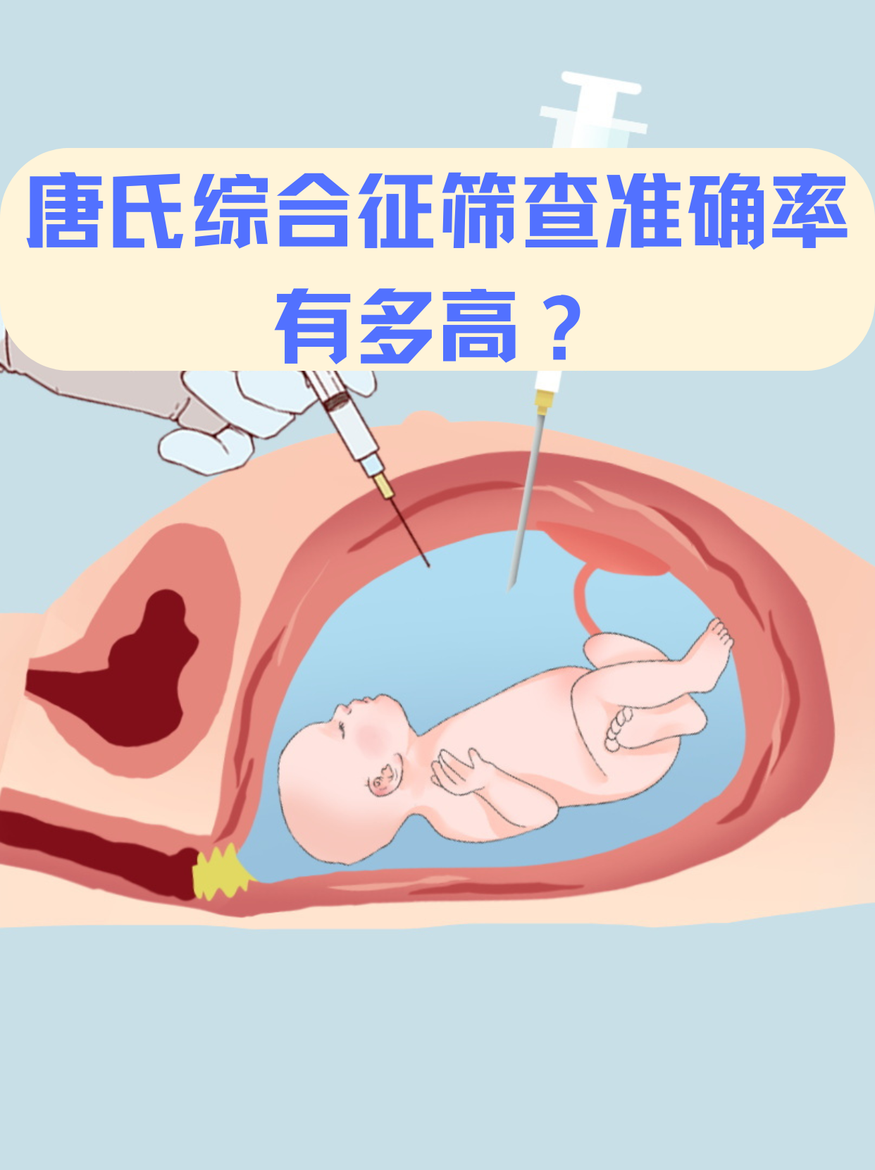 唐氏筛查检查要空腹吗