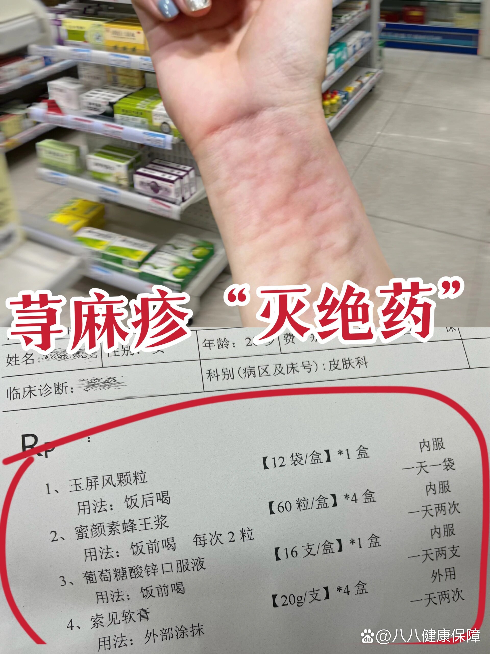 压迫性荨麻疹怎么治疗