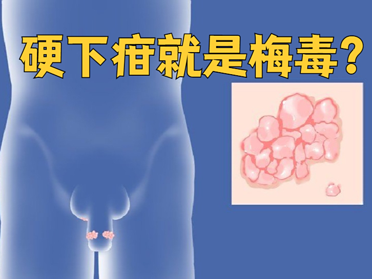 硬下疳是什么样的??