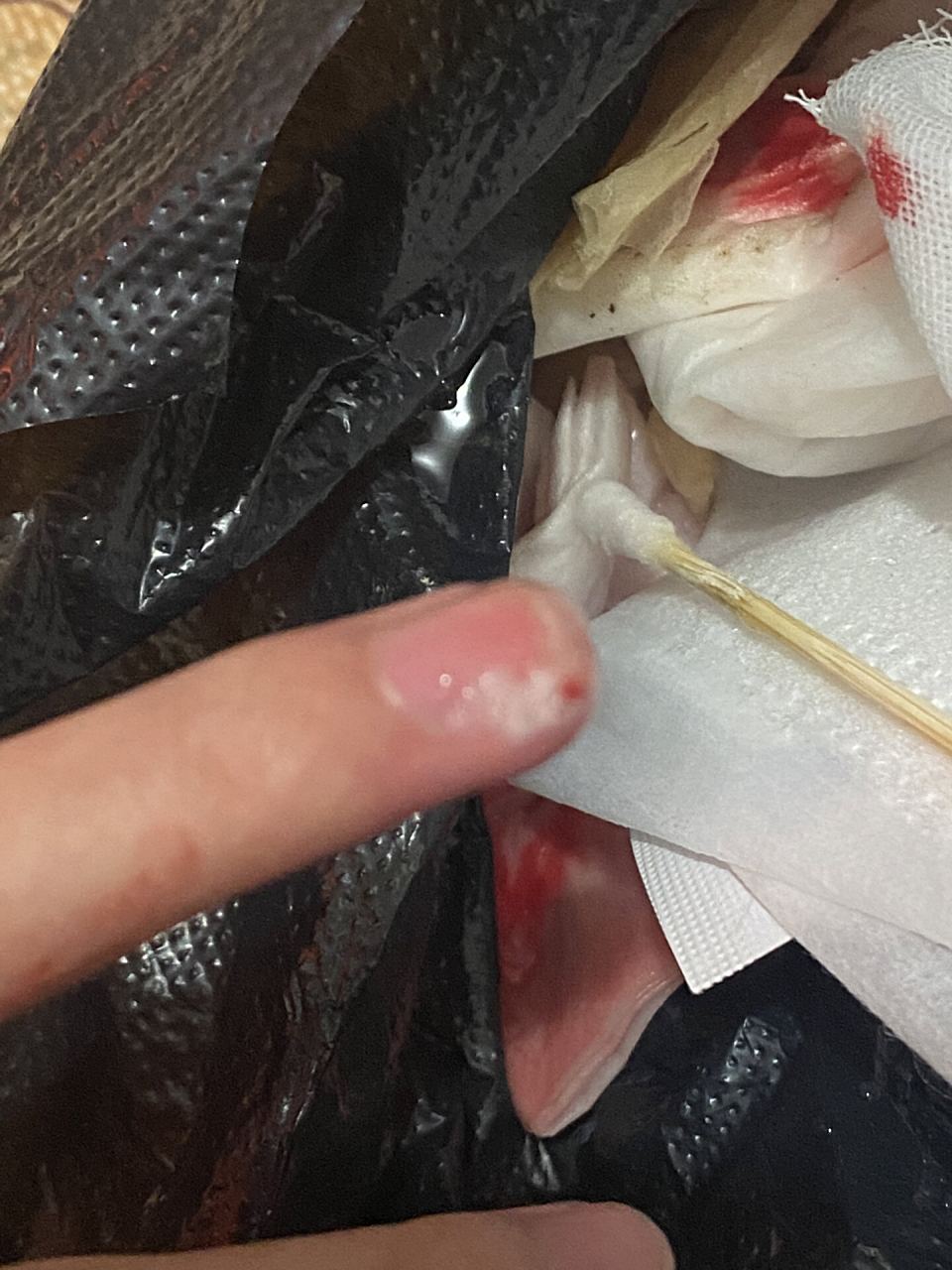 被仓鼠咬了需要打针吗?