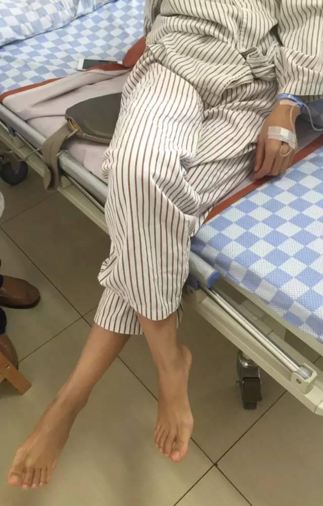 臀肌挛缩症不治会怎么样