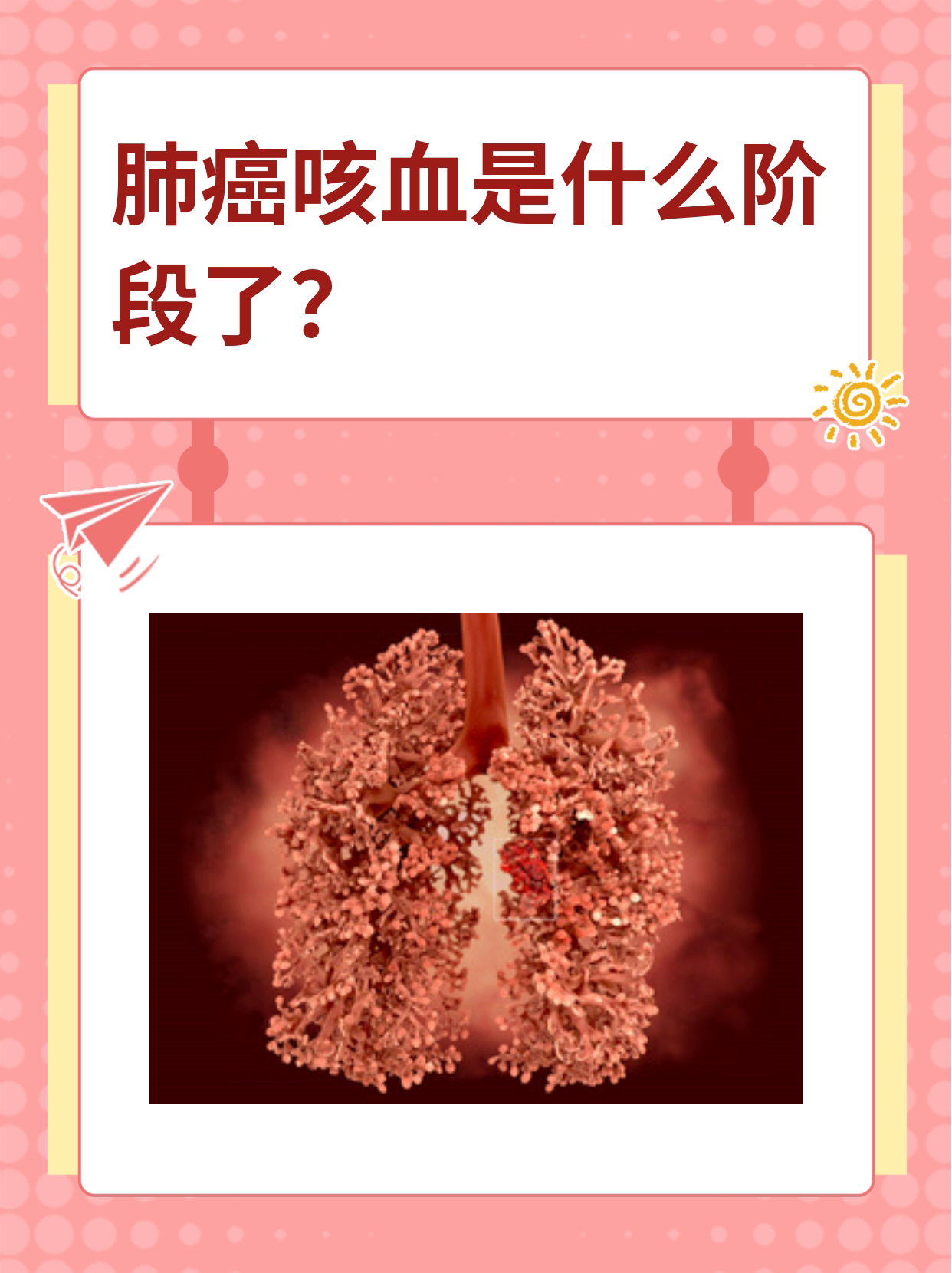 咳嗽时痰中带血能确定是肺癌吗